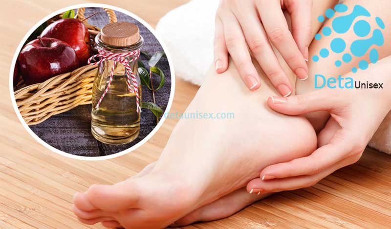 chăm sóc da chân với dấm táo